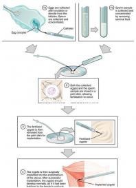 男性孕前檢查事項(xiàng)有哪些