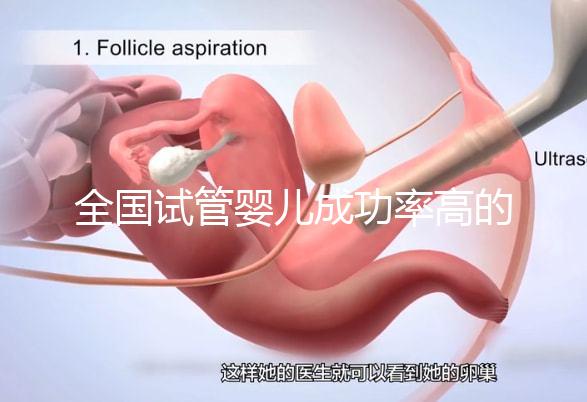 全國(guó)試管嬰兒成功率高的醫(yī)院有哪些?(全國(guó)試管嬰兒成功率高的醫(yī)院目錄一覽)