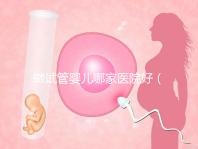 做試管嬰兒哪家醫(yī)院好(上海做試管嬰兒哪家醫(yī)院好)