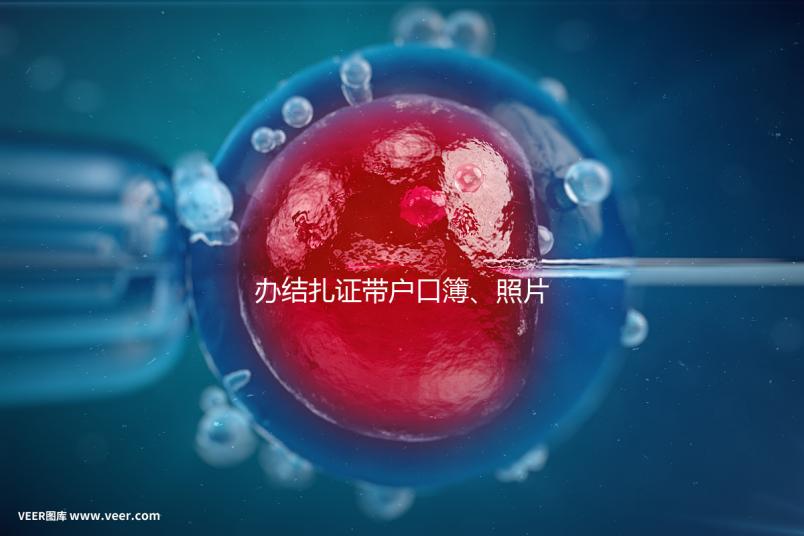 辦結扎證帶戶口簿、照片作用不大,要一樣就足夠~