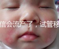 別信會流產了，試管移植后能不能吃胡椒粉聽我說！