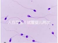 人在孕途！試管嬰兒兩次胎停育,了解這幾招能降低流產(chǎn)風(fēng)險