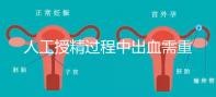 人工授精過程中出血需重視！這3種情況會影響成功率