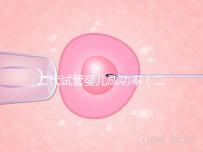 二代試管嬰兒成功率(二代試管嬰兒成功率取決于什么)
