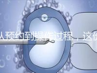 從預(yù)約到操作過程，這份tct檢查流程攻略請查收