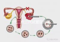 一代二代三代試管區(qū)別美琳達（一代二代三代試管區(qū)別及價格）