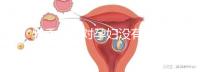 乳香氣味對孕婦沒有影響?致畸、導(dǎo)致流產(chǎn)不能忽視
