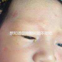 想知道促排期間能不能吃草莓看過來,怎么吃不發(fā)胖有講究