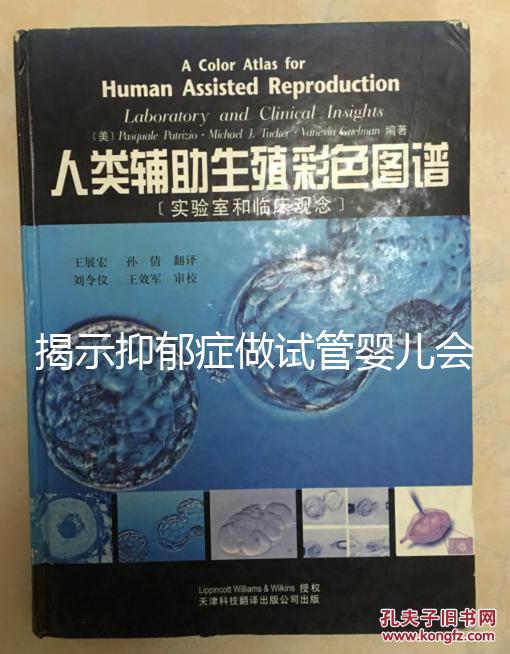 揭示抑郁癥做試管嬰兒會(huì)遺傳給女兒，想避免看這個(gè)