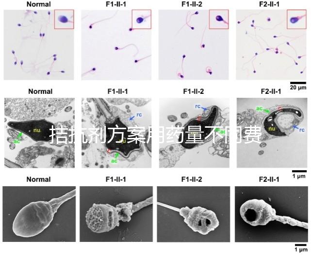 拮抗劑方案用藥量不同費(fèi)用也不一樣，看看大家都花了多少