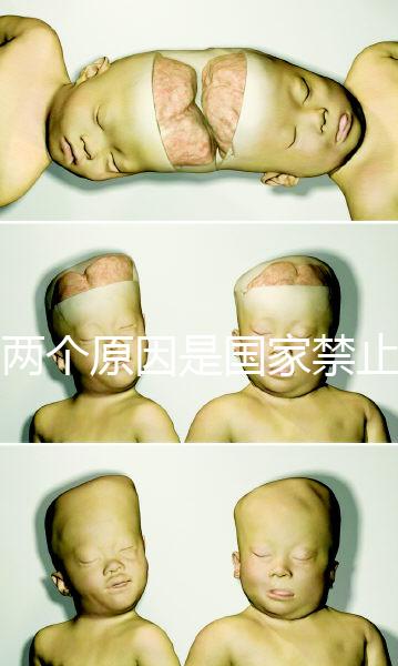 有兩個原因是國家禁止中非混血中國會接受嗎?