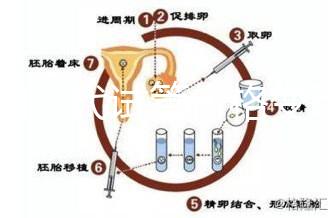 泰國三代試管價格變動，2025年最新費用行情一覽