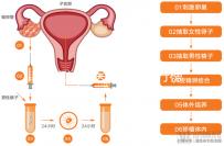 湛江試管醫院前十排行榜，久和醫院vs廣醫附院誰好一覽了然