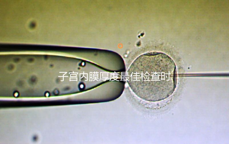 子宮內膜厚度最佳檢查時期,你有必要提前知道!