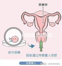 孕多多-試管嬰兒醫院醫生_試管嬰兒哪家醫院好_試管嬰兒全過程流程注意事項