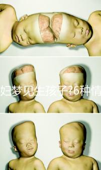 孕婦夢(mèng)見生孩子?6種情形下的寓意各不同