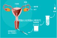 家用胎心儀找胎心有技巧，飯后半個小時測準確率稍高