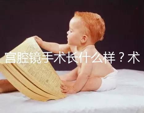 宮腔鏡手術長什么樣?術后要注意什么? ?