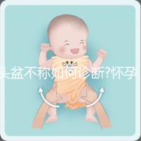 頭盆不稱如何診斷?懷孕9月查出頭盆不稱，是順還是剖