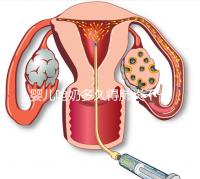 嬰兒?jiǎn)苣潭嗑玫梅窝撞灰欢ǎ@8個(gè)早期癥狀可助你判斷