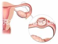 巧克力囊腫試管嬰兒助孕應先治療？網友看法均有差異