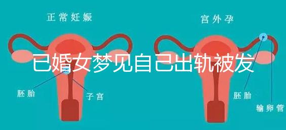 已婚女夢見自己出軌被發(fā)現(xiàn)什么意思來瞧，或和心理有關(guān)系