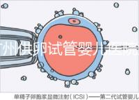廣州供卵試管嬰兒醫院匯總,真實案例告訴你廣東哪家最好