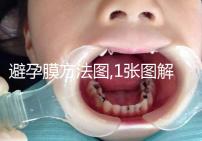 避孕膜方法圖,1張圖解讓你明白如何使用