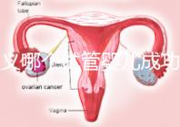 遵義哪個試管嬰兒成功率高?貴州生殖中心醫院2024年排名參考