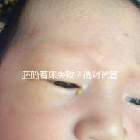 胚胎著床失敗?選對試管嬰兒醫生很重要