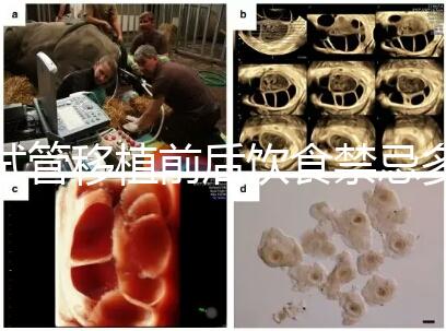 試管移植前后飲食禁忌多，十大不利于胚胎著床的水果別亂吃