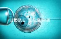 試管嬰兒一超是腹部b超還是陰超要早知，二者區(qū)別大請注意