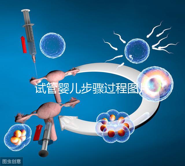 試管嬰兒步驟過(guò)程圖片