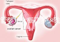 試管嬰兒大概花多少錢（試管嬰兒大概花多少錢費用）