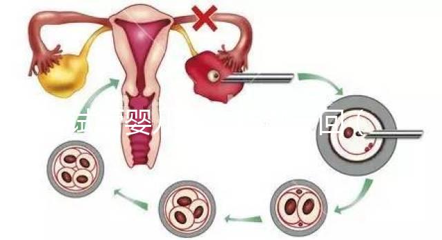 試管嬰兒多少錢做一回(試管嬰兒多少錢做一回最好)