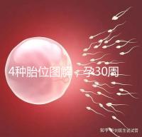 4種胎位圖解，孕30周這個姿勢最適合順產