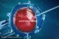 45歲懷孕藥流有風(fēng)險(xiǎn)！這4種并發(fā)癥極易影響安全