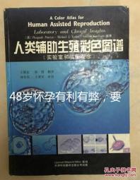 48歲懷孕有利有弊，要不要生需考慮這3點！