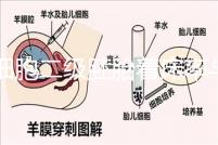 6細胞二級胚胎著床率與養(yǎng)囊成功率解讀,拿不準移植與否戳