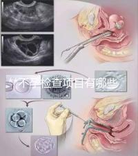 **不孕檢查項(xiàng)目有哪些？