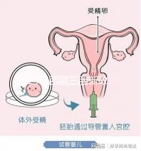 2024年西藏三胎新政策出臺,拉薩、日喀則產(chǎn)假戳多久?