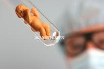 2024年陜西省規(guī)定發(fā)放獨生子女費，包括咸陽市補貼標準和領(lǐng)取流程