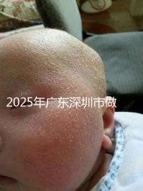 2025年廣東深圳市做第三代試管嬰兒費用,官方收費明細(xì)公開!